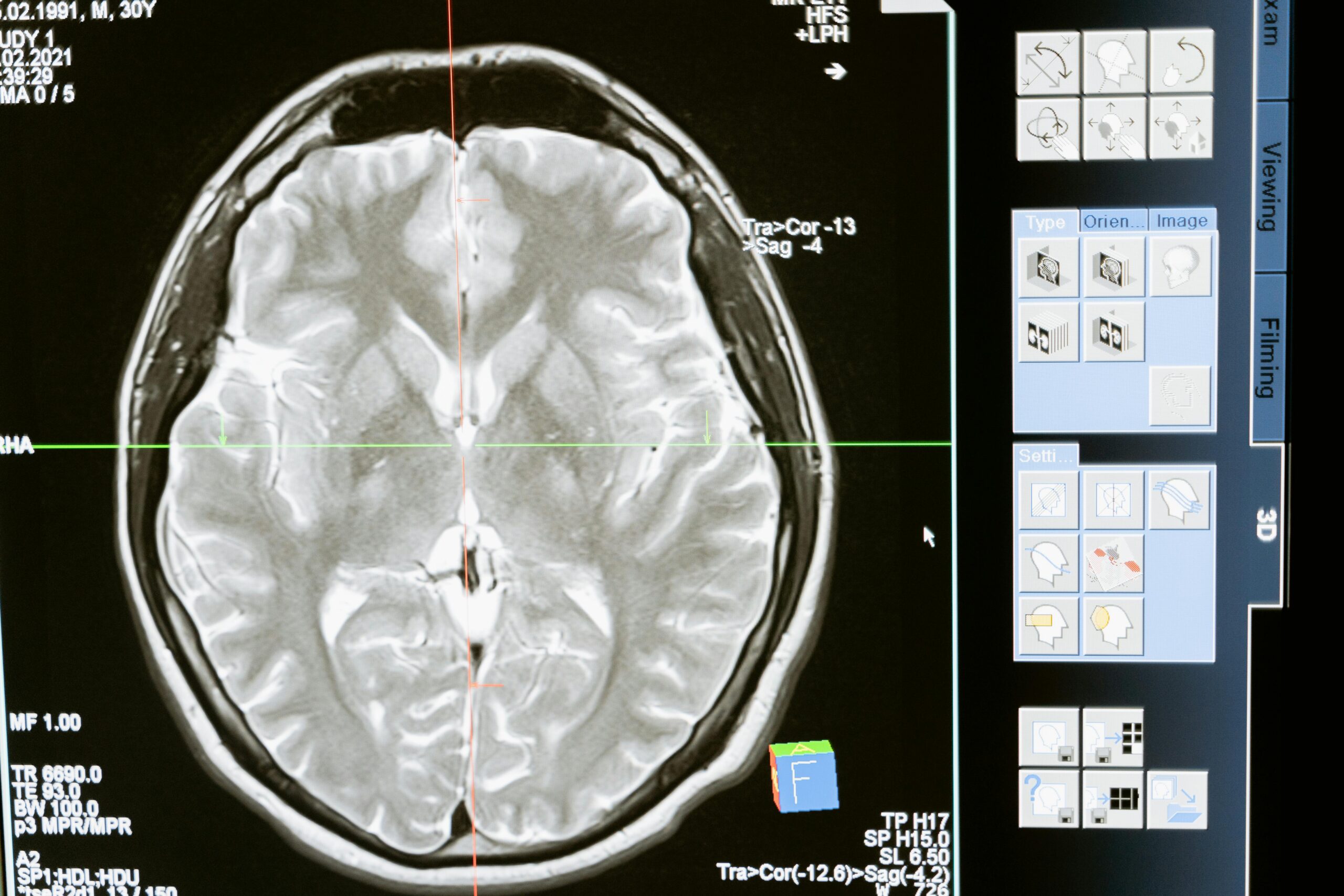 Mapping the Moral Brain: Probing the Architecture of Ethical Decision-Making with TMS