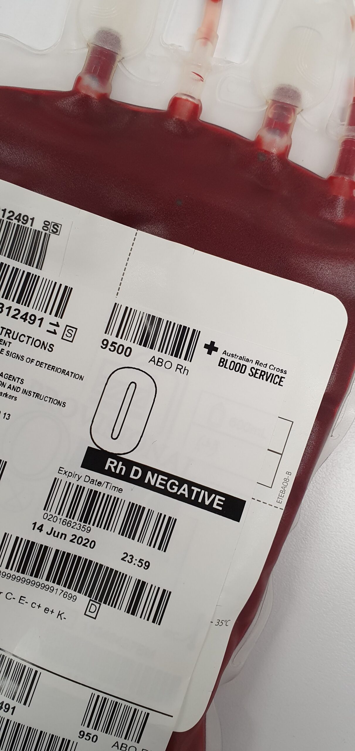 The End of an Absolute: Jehovah’s Witnesses Reconsider Blood Product TransfusionsBlood Products